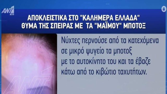«Μου έκαναν ενέσεις μαρμαρόσκονης» – Σοκαριστική καταγγελία για το κύκλωμα των παράνομων botox στην Ελλάδα (video)