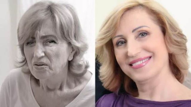 «Ξεφορτώθηκα όλες τις ρυτίδες σε 21 ημέρες – Τώρα είμαι ίδια η κόρη μου!»: Οι γιατροί κρύβουν την αλήθεια, έτσι θα εξαφανίσεις τις ρυτίδες!