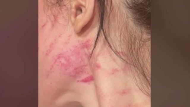«Όπου βρίσκει την κοπέλα, στο δρόμο, στην δουλειά την ξυλοκοπεί» – Ζήτησε από τον σύντροφό της να χωρίσουν και την “εσπασε” στο ξύλο (Video)