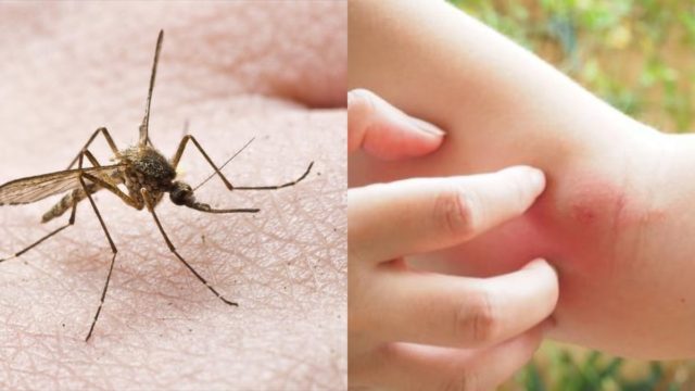 Ξεχάστε φιδάκια και σιτρονέλες: Αυτή είναι η μυρωδιά που δεν αντέχουν με τίποτα τα κουνούπια