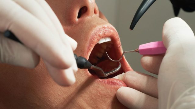 Dentist Pass: Περισσότερες από 129.000 αιτήσεις για το πρόγραμμα προληπτικής οδοντιατρικής φροντίδας
