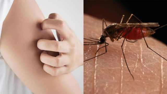 Ούτε ένα, ούτε δύο: 5 σωτήρια σπιτικά tips για να απαλλαγείτε από τον εφιάλτη των κουνουπιών