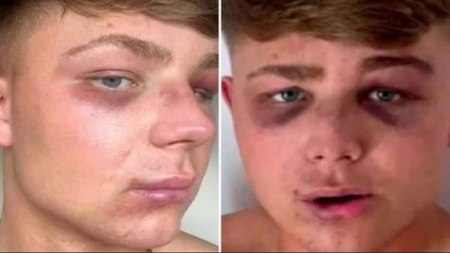 «Για μια selfie, με έστειλαν στο νοσοκομείο» – Συγκλονίζει ο Βρετανός που ξυλοκοπήθηκε από μπράβους στον Λαγανά