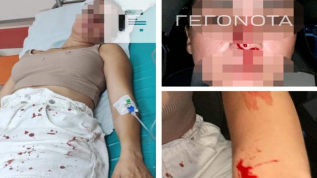 Εφιάλτης για 30χρονη στο Βόλο: Ξυλοκοπήθηκε από τον 34χρονο πρώην σύντροφό της μπροστά στο 4,5 ετών παιδάκι της – «Με πιάνει από το κεφάλι και με κουτουλάει στη μύτη!»