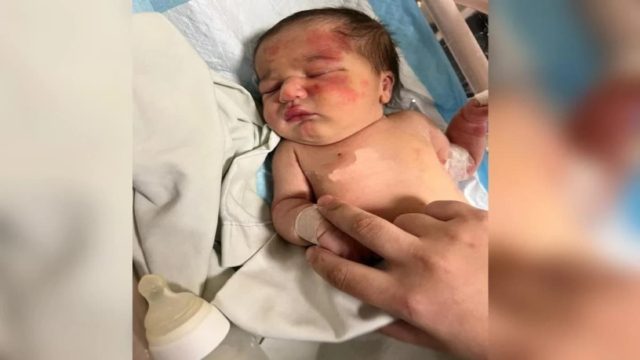 Συγκινητική ιστορία: Αδέσποτος σκύλος έσωσε μωρό – Το είχαν πετάξει στα σκουπίδια