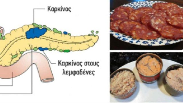 14 τροφές που έχουν αποδειχθεί ότι προκαλούν καρκίνο – Δεν πρέπει να τις ξαναβάλετε στο στόμα σας