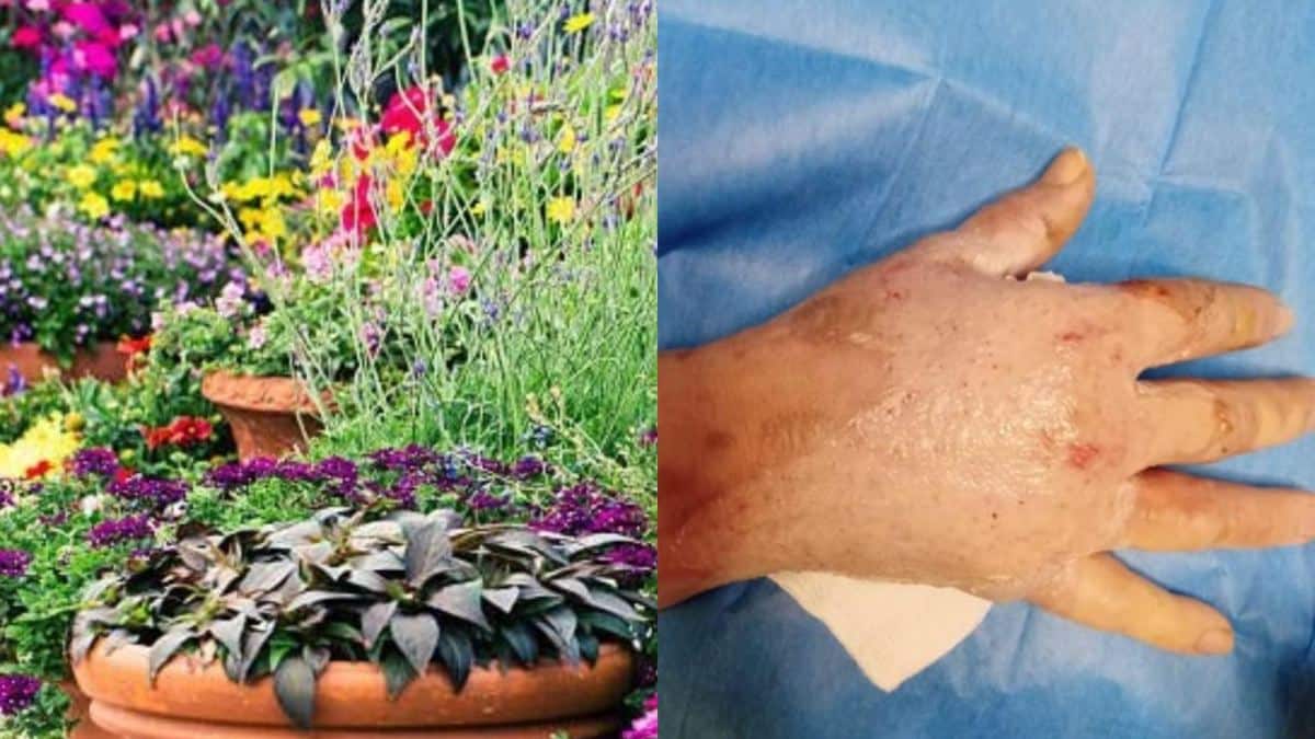 Αυτό είναι το επικίνδυνο φυτό που προκαλεί τύφλωση εγκαύματα και ουλές – Αν το δείτε μην το αγγίξετε