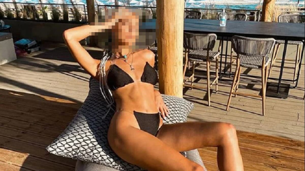 Σάλος με πασίγνωστη παίκτρια Survivor – Προσθετική στήθους μετά το παιχνίδι (ΦΩΤΟ)