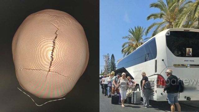 Χανιά: Σοκάρει η εικόνα 5χρονου με ανοιχτό κρανίο μετά από τροχαίο – Το παιδί τραυματίστηκε κάτω από «αδιευκρίνιστες συνθήκες» λέει ο γιατρός (photo)