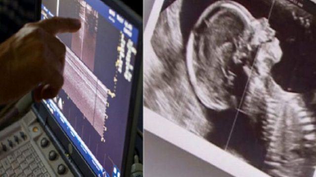 Ζευγάρι με δίδυμα περιμένει και πάλι παιδί, αλλά ο γιατρός δείχνει το υπερηχογράφημα και ο σύζυγος αμέσως λιποθυμά!