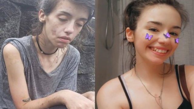«Πάλεψα σκληρά, είμαι 9 μήνες καθαρή. Δημοσιεύω την ιστορία μου για να δείξω ότι όλοι μπορούν να το κάνουν» – Το συγκινητικό μήνυμα 24χρονης για τη μάχη της με τα ν@ρκ@τ@κ@ (photo)
