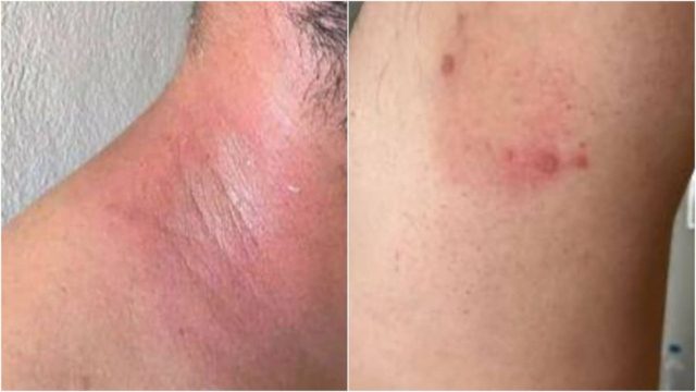 «Ο σύζυγός μου εμφάνισε εξανθήματα σε όλο του το σώμα από τα μολυσμένα νερά»: Καταγγελία «βόμβα» από κάτοικο στη Μαραθέα Καρδίτσας (video)