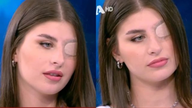 Ραγίζει καρδιές η 19χρονη Ελεονώρα που έχασε το αριστερό της μάτι σε τροχαίο – «Δεν θυμάμαι τι έγινε, έπεσα σε κώμα» (video)