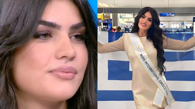 Συγκλονίζει η Μις Ελλάς Ζωή Ασουμανάκη για την αλωπεκία – «Όταν άρχισα να βλέπω κενά στο κεφάλι μου, έπαθα σοκ» (video)