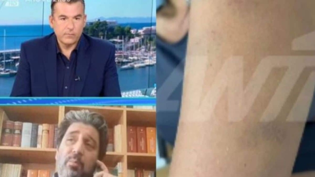 Πασίγνωστος επιχειρηματίας ξυλοκόπησε την εγκυμονούσα σύντροφό του – Μεταφέρθηκε με σπασμούς από ομάδα ΔΙΑΣ στον 9ο μήνα κύησης