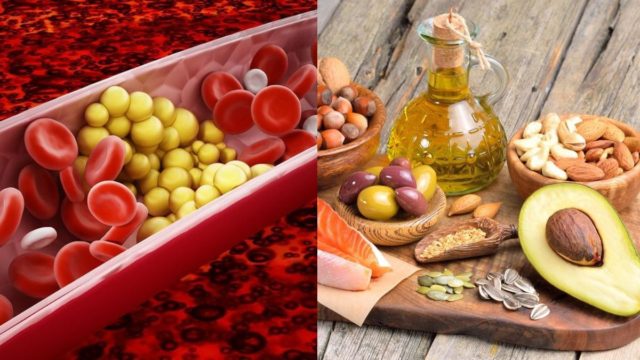 Ασπίδα στην χοληστερίνη: Αυτά είναι τα 5 top τρόφιμα που την καταπολεμούν