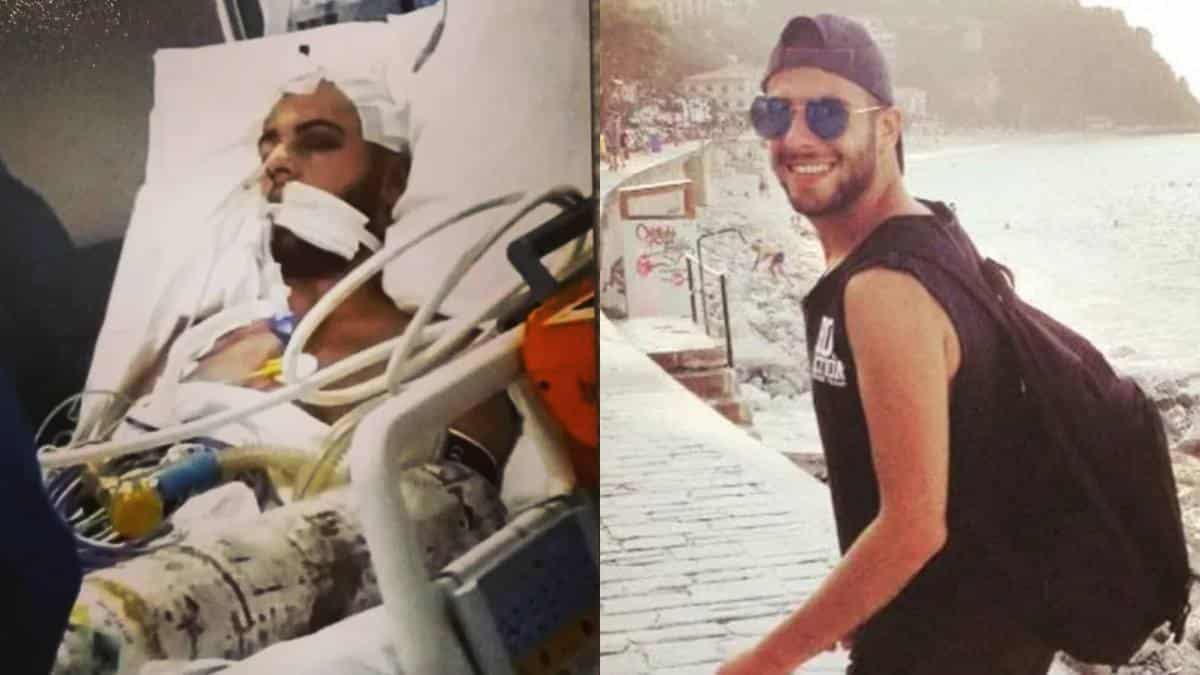 «Μου έδιναν 5% πιθανότητες να ζήσω, η θεραπεύτριά μου έκλαιγε…» – Η σπαρακτική ιστορία του Γιάννη Κολέτσου που ξυλοκοπήθηκε έξω από κλαμπ (photos)