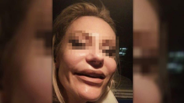 «Τα μάγουλά μου πέτρωσαν, είχα αφόρητους πόνους»: Νέα καταγγελία για το ινστιτούτο της απάτης