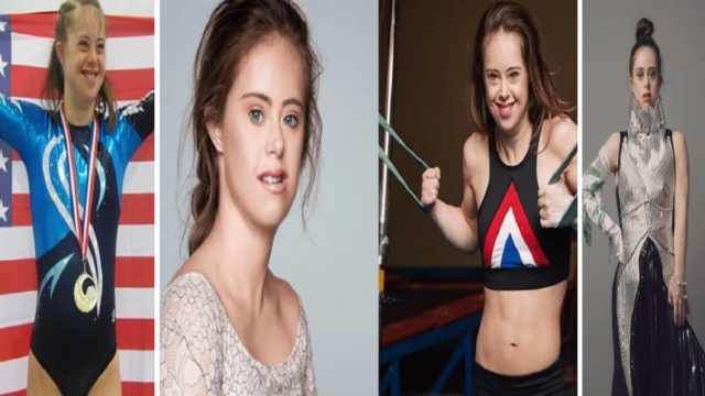 Chelsea Werner, η δύναμη της θέλησης: Το κορίτσι “φαινόμενο” με σύνδρομο Down που ξεπέρασε τα όρια της, έγινε παγκόσμια πρωταθλήτρια γυμναστικής και μοντέλο (Video)