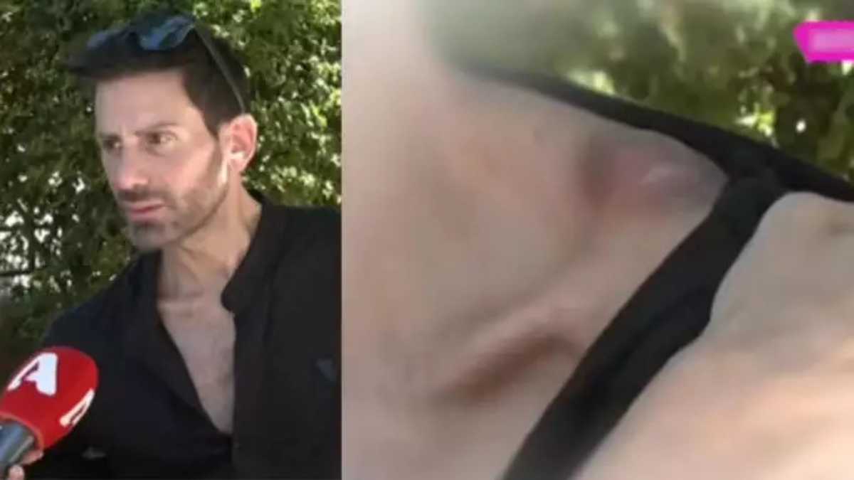 Γενναία μάχη για τον Νίκο Φλωρινιώτη: «Οι γιατροί μου είπαν δεν ξέρουν αν θα ζήσω» – Οι φρικτοί πόνοι και οι παρενέργειες