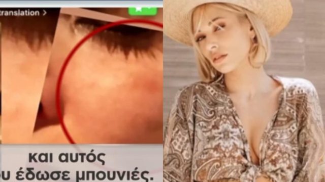 Ξεσπά η Μικαέλα Φωτιάδη για τον ξυλοδαρμό της: «Μπορεί να είναι κάποιος που έχει τρελαθεί, που έχω φύγει από τη ζωή του» (video)