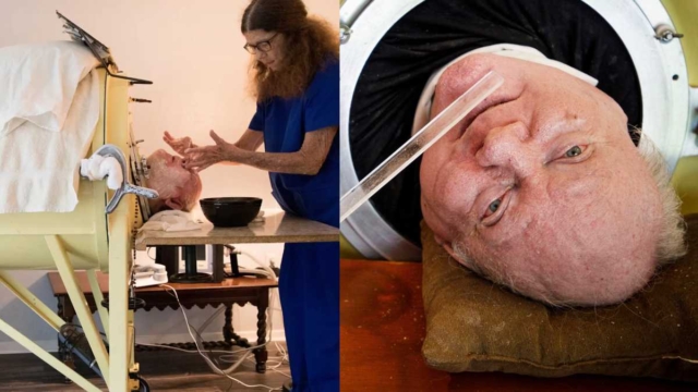 Πέθανε ο Πολ Αλεξάντερ, ο άνθρωπος που έζησε 72 χρόνια σε «σιδερένιο πνεύμονα»