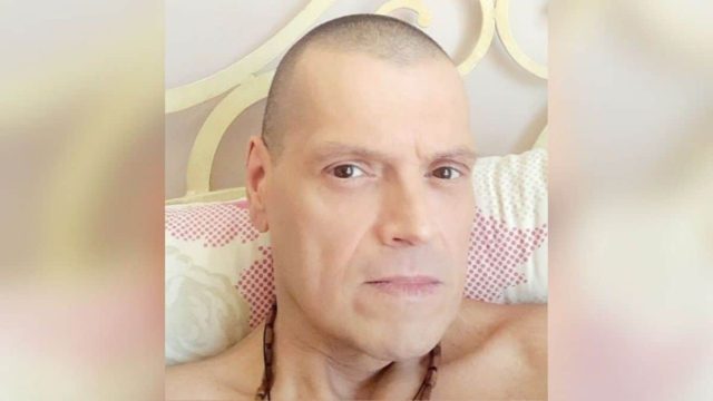 «Είμαι ανήμπορος με μπαστούνι και μελανιασμένος»: Η φωτογραφία του Γιώργου Δασκαλάκη με το σώμα του μετά τις εγχειρήσεις για τον καρκίνο