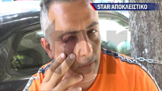 Παλαιό Φάληρο: Ξυλοκόπησαν άγρια και δάγκωσαν ελεγκτή εισιτηρίων σε λεωφορείο – «Με χτυπούσαν στο κεφάλι με κλειδί…» (video)