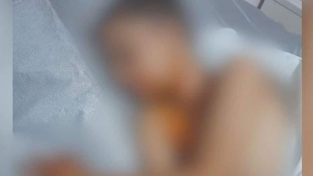 Θλίψη στην Πάτρα: «Μπαμπά, θα πεθάνω;» – Τα πρώτα λόγια του 9χρονου που δέχθηκε βεγγαλικό στον λαιμό