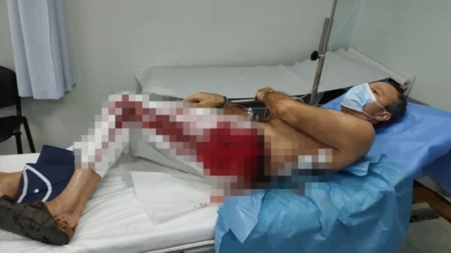 Μαρούσι: Σοκαριστική φωτογραφία από άγρια επίθεση νεαρών με μαχαιρίες σε 54χρονο (photo)