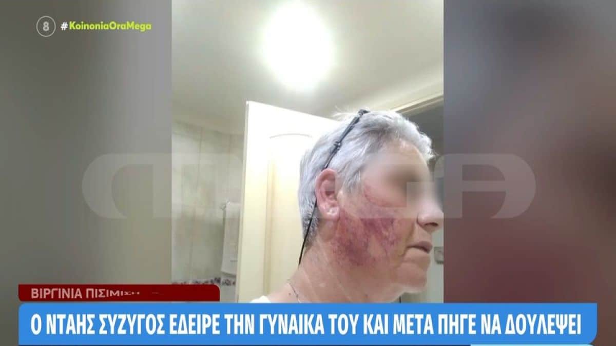 Χαλκίδα: Μαρτύρησε νοσηλεύτρια στα χέρια του συζύγου της – «Θα τον καταγγείλω, το χρωτάω στα παιδιά μου…»