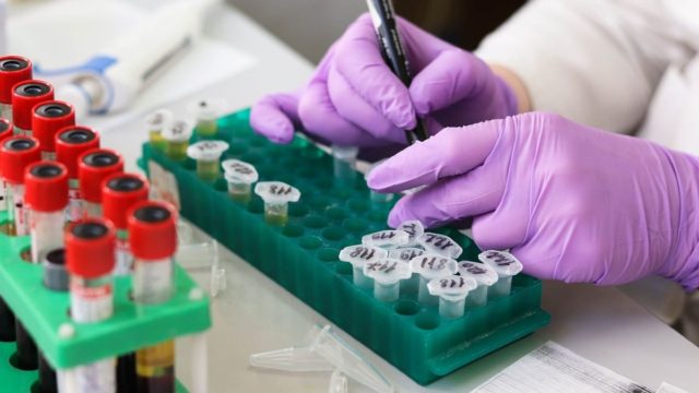 Πανικός τα τελευταία 24ωρα: Γιατί προκλήθηκε ανησυχία με τα self tests για τον καρκίνο του παχέος εντέρου (video)