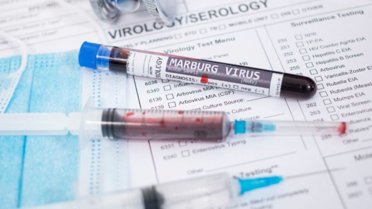 Ποιος είναι ο θανατηφόρος ιός Marburg που θερίζει την Αφρική και έφτασε στην Ευρώπη – Πώς μεταδίδεται