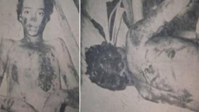 Η φρικιαστική ιστορία της 14χρονης Σπυριδούλας: Τα αφεντικά της την «σιδέρωναν» ζωντανή