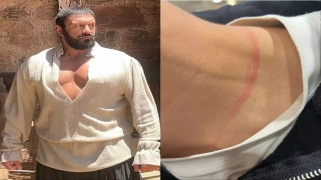 Αδιανόητο σκηνικό για τον ηθοποιό της «Μάγισσας» Γιάννη Τσαγκαράκη: Συμμορία ανηλίκων άρπαξε χρυσή αλυσίδα από τον λαιμό του γιου του
