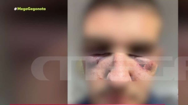 «Με χτυπούσαν με μίσος»: 15 ανήλικοι ξυλοκόπησαν άγρια 17χρονο γιατί μίλησε σε κοπέλα (video)