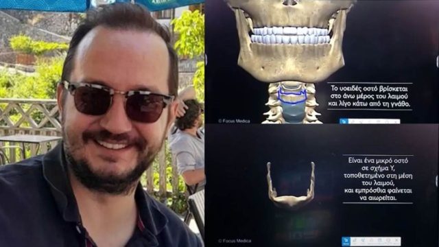 Τι είναι το υοειδές οστό που βρέθηκε σπασμένο στον Βασίλη Καλογήρου;