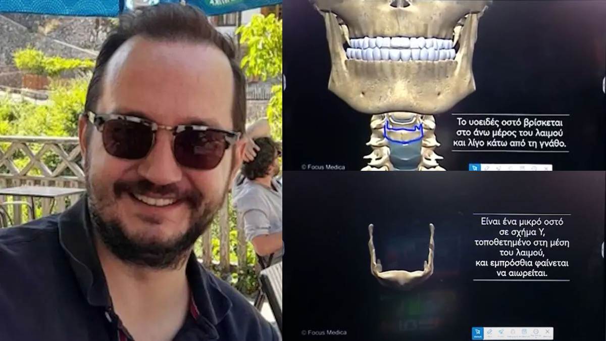 Τι είναι το υοειδές οστό που βρέθηκε σπασμένο στον Βασίλη Καλογήρου;