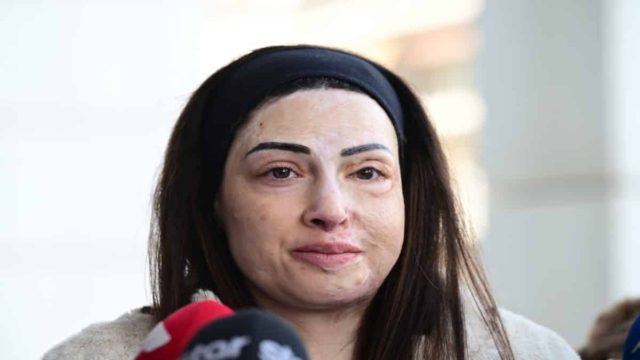Ιωάννα Παλιοσπύρου: Η ζωή της και η επίθεση με βιτριόλι έγιναν ντοκιμαντέρ – Στόχος να ταξιδέψει στο εξωτερικό