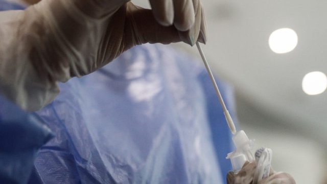 ΕΟΔΥ: Τα νέα σοβαρά κρούσματα γρίπης και οι διασωληνώσεις της εβδομάδας