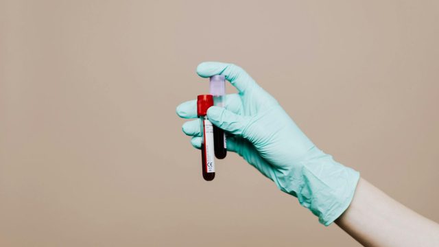 Εγκεφαλικό: Αν έχεις αυτή την ομάδα αίματος κινδυνεύεις περισσότερο