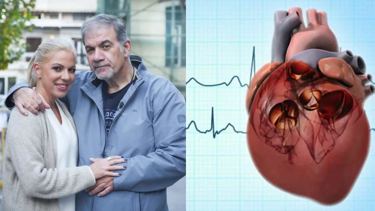 Κολπική μαρμαρυγή: Τι ακριβώς είναι το σοβαρό επεισόδιο που υπέστη ο Δημήτρης Σταρόβας, εκτός από το εγκεφαλικό;