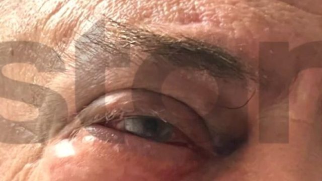 Συνελήφθη ο Ισραηλινός για την βίαιη επίθεση στον επιχειρηματία στη Γλυφάδα – Τι υποστηρίζει ο ίδιος