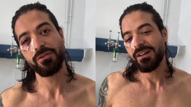 Σοκάρει ο Άρης Μουγκοπέτρος: Τα πρώτα λόγια μετά το ατύχημα με την κροτίδα – «Δυστυχώς την πάτησα από τον μεγαλύτερο φόβο μου»