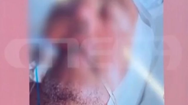 Χαροπαλεύει ο 48χρονος που ξυλοκοπήθηκε στα Γλυκά Νερά – Άπορη η μητέρα του, ζει χωρίς ρεύμα