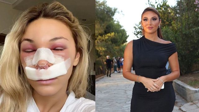Χρύσα Χατζηγεωργίου: Σούσουρο στο TikTok με την πλαστική στη μύτη της – «Εσύ είσαι ο κανένας που θα…»