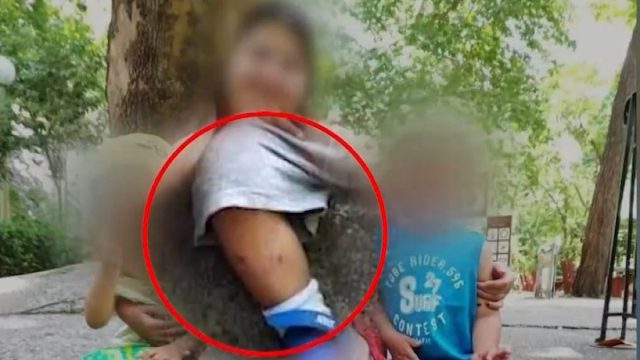 Ζούσαν τον εφιάλτη τα παιδάκια στη Λάρισα: Η μητέρα ανέβαζε φωτογραφίες όπου φαίνονταν τα καψίματά τους!