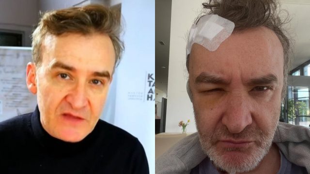Νίκος Ορφανός: Χειρουργείο για όγκο στον εγκέφαλο για τον γνωστό ηθοποιό – Η περιπέτεια που κανείς δε γνώριζε