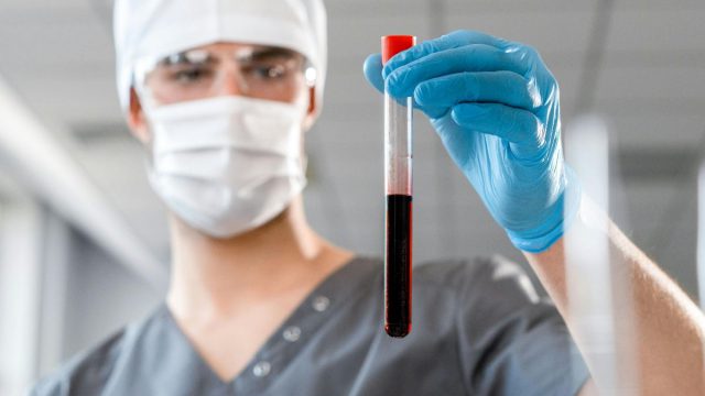 19 Ιουνίου: Παγκόσμια Ημέρα Δρεπανοκυττάρωσης – Μια κληρονομική ασθένεια που μπορεί να οδηγήσει σε θάνατο