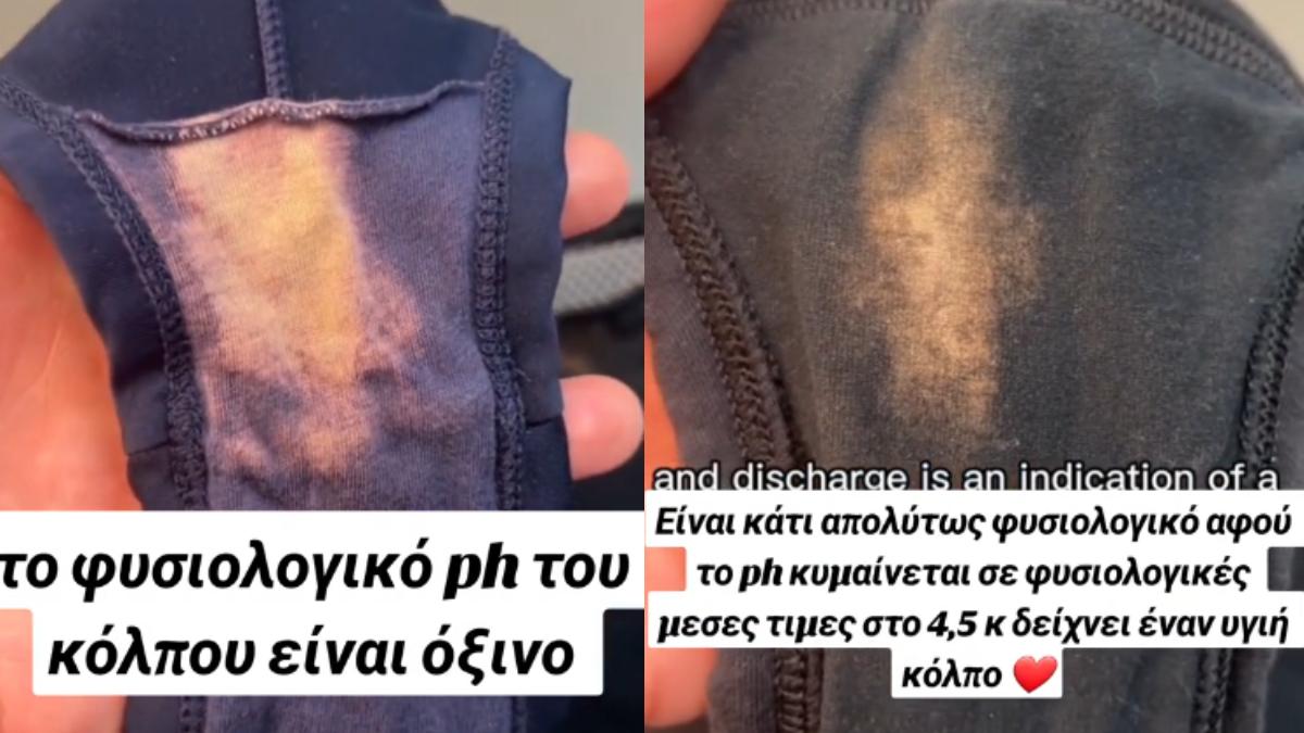 Γυναικεία εσώρουχα: Γιατί ξεθωριάζουν στον καβάλο και πώς αυτό συνδέεται με την υγεία – Το βίντεο στο TikTok που μας έλυσε την απορία